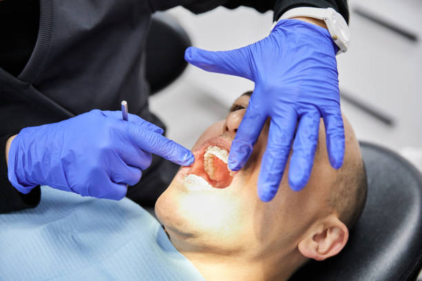 Best Knocked-Out Tooth (Avulsed Tooth) Treatment in Kekoskee, WI